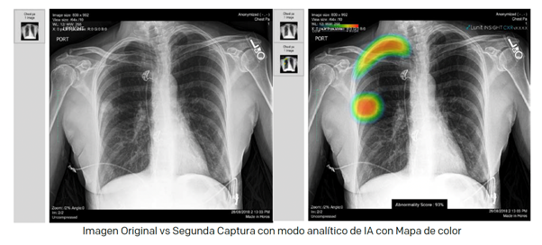 Radiografías de tórax